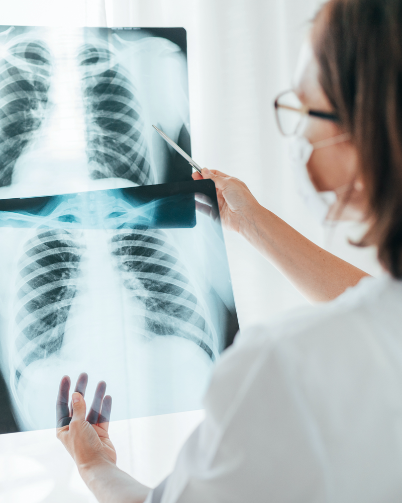 HCP looking at x-ray